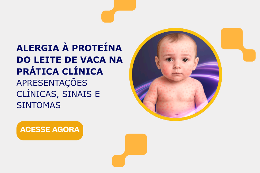 APLV na prática clínica: apresentação clínica, sinais e sintomas APLV na prática clínica: apresentação clínica, sinais e sintomas